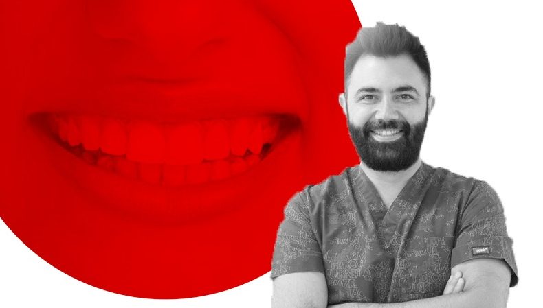 Gülüş Estetiği: Recontouring Nedir? Gülüş Estetiği: Recontouring Nedir?