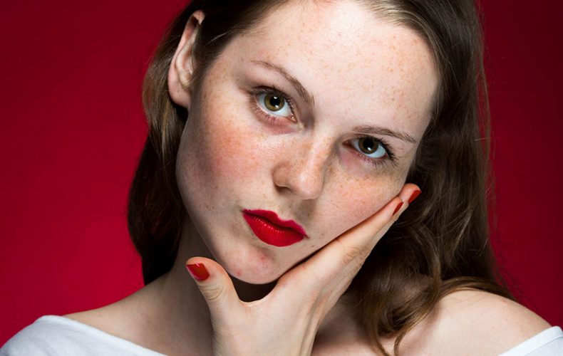 Kelebek hastalığı (Lupus) nedir? – Belirtileri ve tedavi yöntemleri nelerdir? Kelebek hastalığı (Lupus) nedir? – Belirtileri ve tedavi yöntemleri nelerdir?