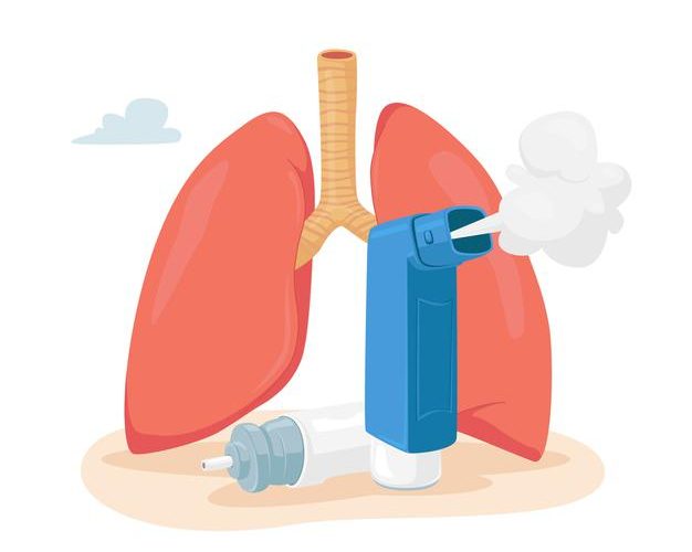 Kronik Obstrüktif Akciğer Hastalıkları (KOAH) Hakkında Bilgiler | Kronik Obstrüktif Akciğer Hastalıkları (KOAH) Hakkında Bilgiler |