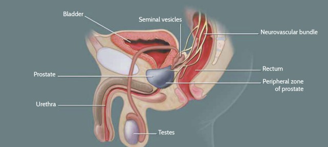 Prostat Kanseri Nedir? Belirtileri ve Tedavisi Prostat Kanseri Nedir? Belirtileri ve Tedavisi