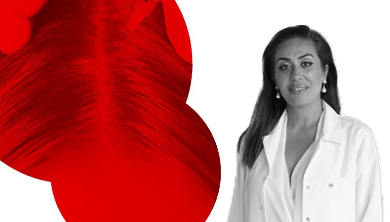 Saç Mezoterapisi Hakkında Merak Edilenler – Uzm. Dr. Tuğçe Özkapu Saç Mezoterapisi Hakkında Merak Edilenler – Uzm. Dr. Tuğçe Özkapu