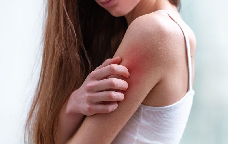 Sedef Hastalığı Nedir? – Belirti ve Tedavi Yöntemleri Sedef Hastalığı Nedir? – Belirti ve Tedavi Yöntemleri