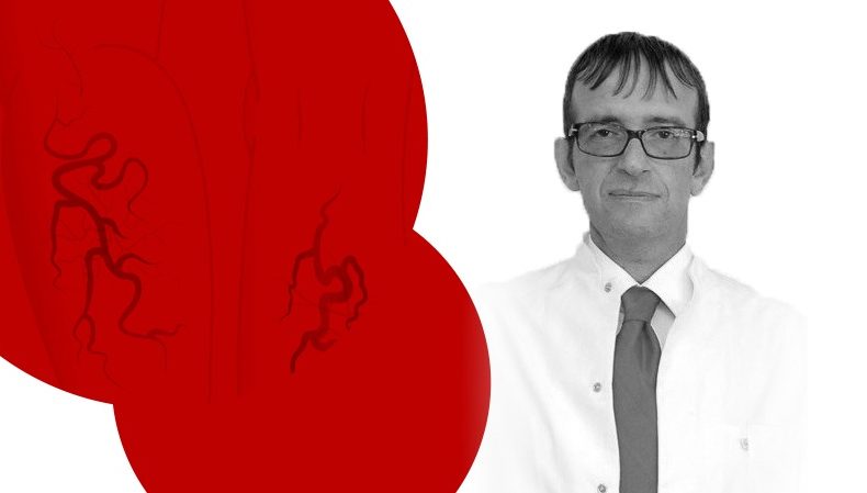 Varis nedir? Belirti ve tedavi yöntemleri nelerdir? Varis nedir? Belirti ve tedavi yöntemleri nelerdir?